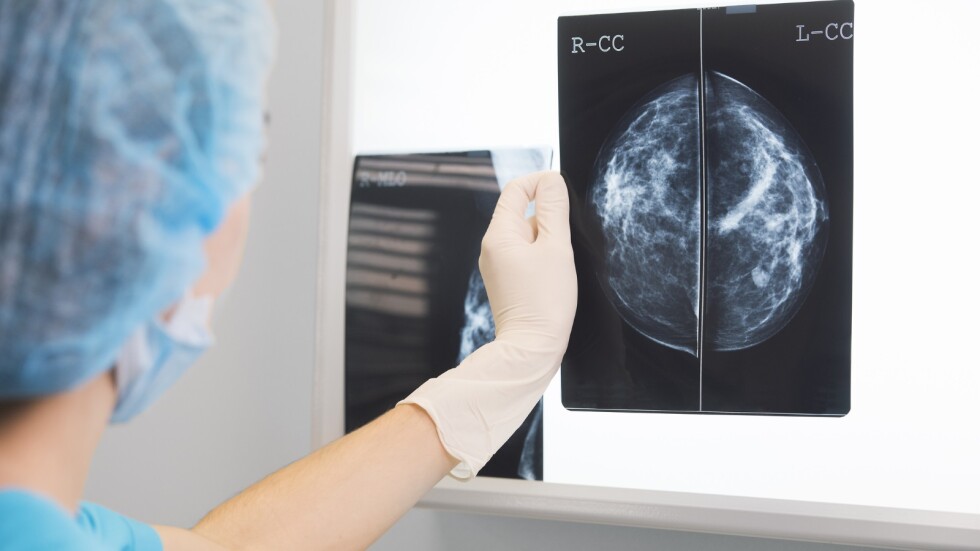 Американски специалисти излекуваха рак на гърдата с имунотерапия