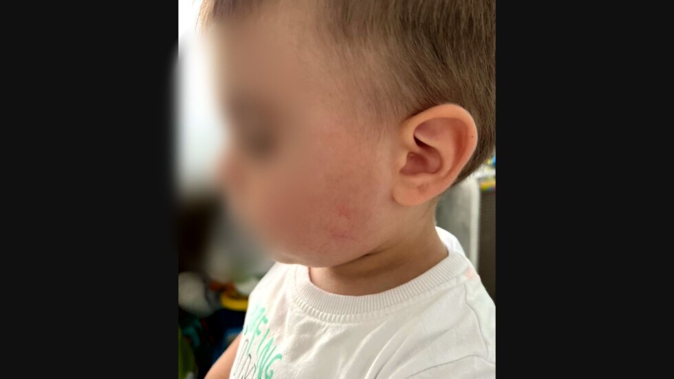 Насилие над дете в градина в София: Удряно е от медицинската сестра