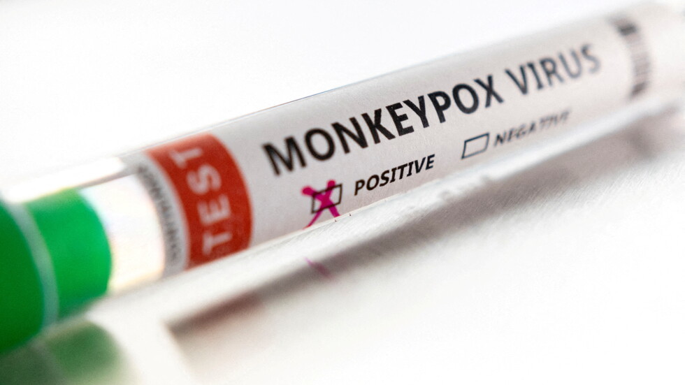 Великобритания е в риск да остане без ваксини срещу маймунска шарка