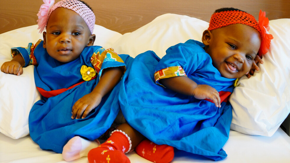 "Спасените": Сиамски близначки бяха разделени след 27-часова операция