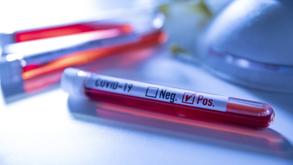 Германия и COVID-19: Масово тестване за коронавирус 