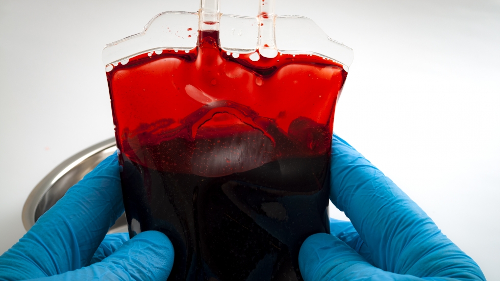 Изследване: Рискът от COVID-19 може да е свързан с кръвната група
