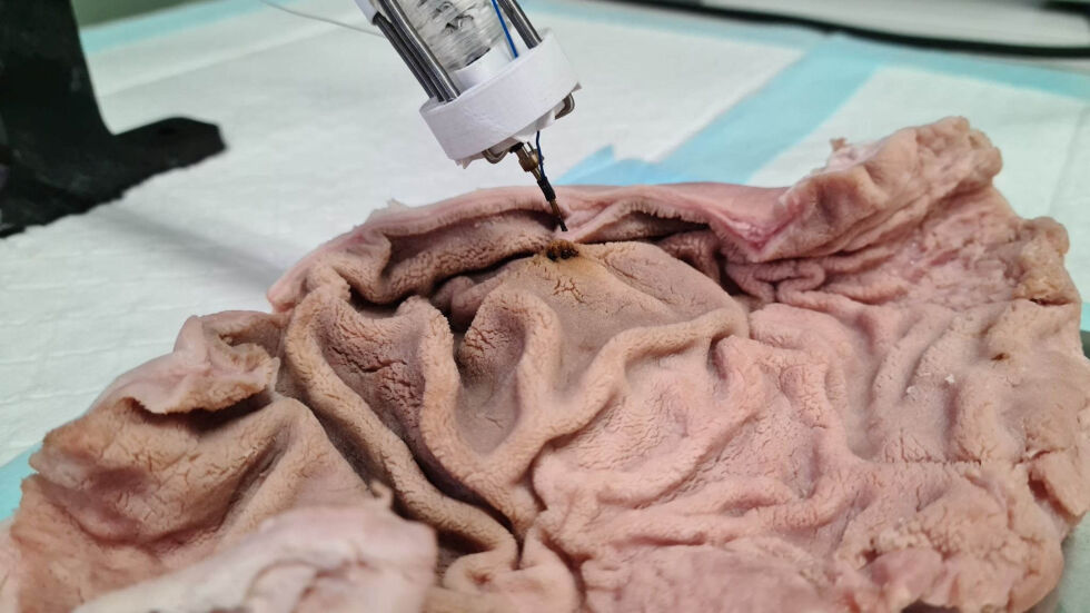 Австралийски биоинженери отпечатват 3D органи директно в човешкото тяло (ВИДЕО и СНИМКИ)