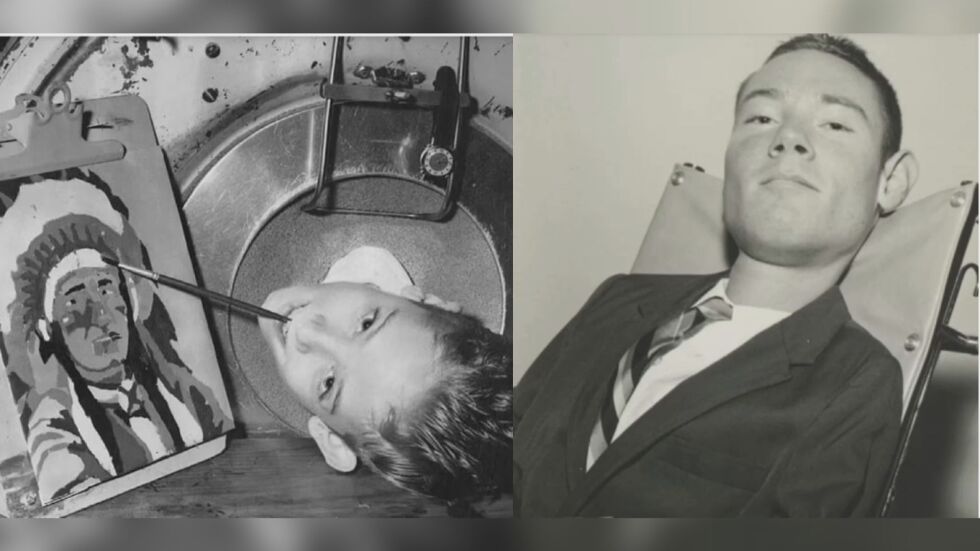 „Той отдавна трябваше да е мъртъв“: Почина последният човек с железен бял дроб - 70 г. по-късно