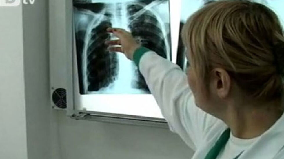  80 хиляди нови случаи на туберкулоза всяка година в Европа