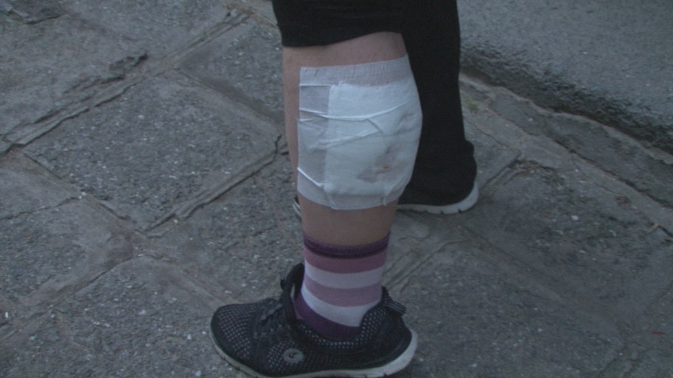 Питбул разкъса крака на жена в Асеновград