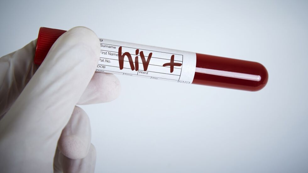 Учени приложиха терапия с вируса ХИВ при имунен дефицит