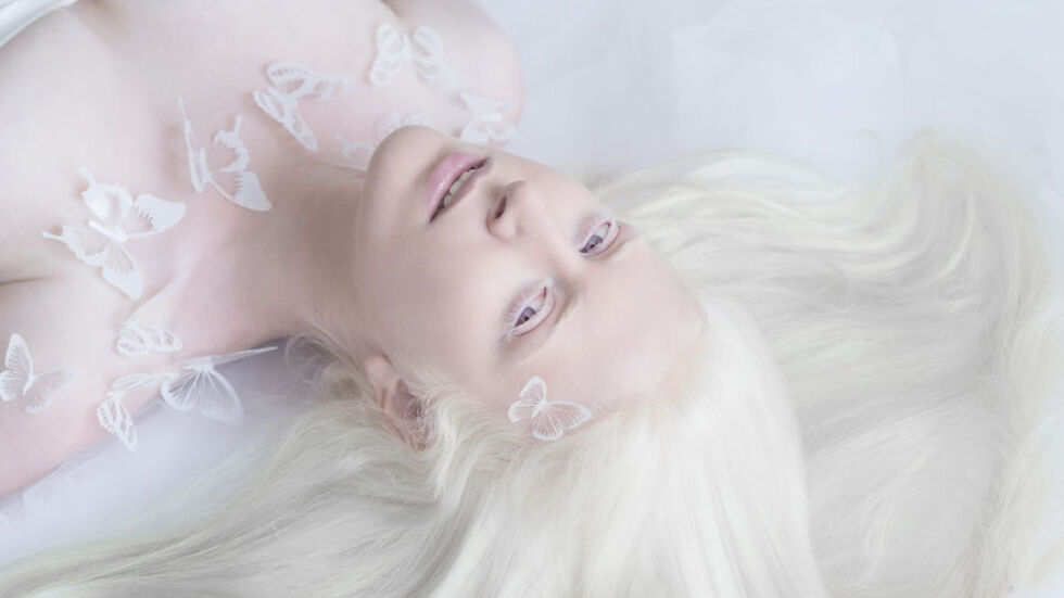 Порцелановата красота на албиносите