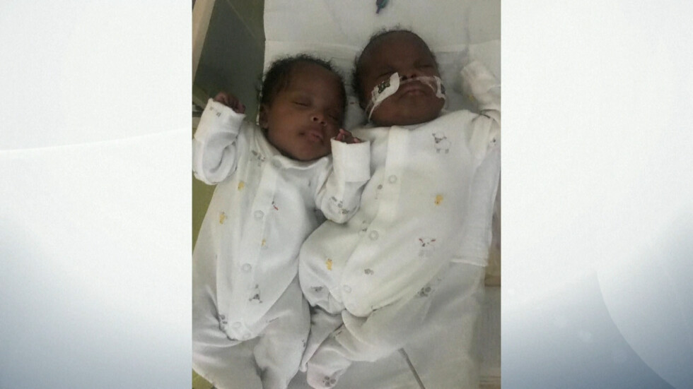 Бременна британка, изпаднала в кома заради COVID-19, роди здрави близнаци (ВИДЕО)