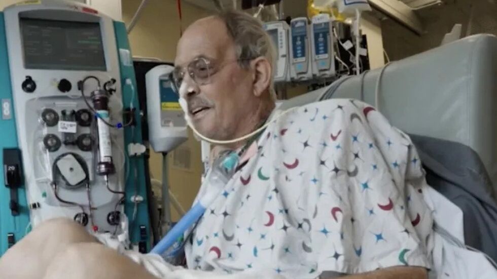 Вторият мъж с трансплантирано сърце от прасе почина 6 седмици след операцията