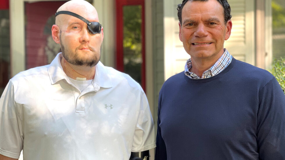За пръв път в света: Трансплантираха ново око на мъж в САЩ (ВИДЕО и СНИМКИ)