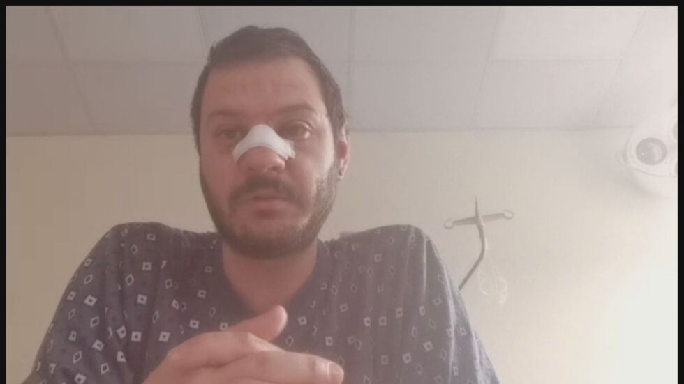 Със счупен нос в протестите срещу БФС: Жандармерията ме би, изправих се, а след това ме удари полицай