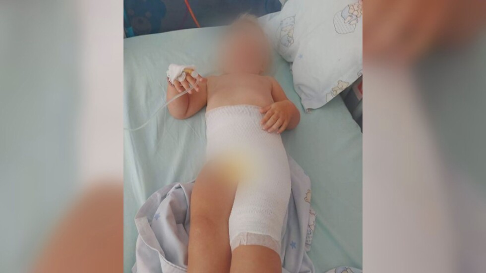 2-годишно дете получи изгаряне в детска ясла в София